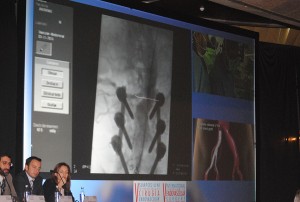 Dr. Merino Diaz en el V Simposium Internacional de Cirugía Endovascular